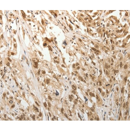 Immunohistochemistry - ADIPOR2 Antibody from Signalway Antibody (37086) - Antibodies.com