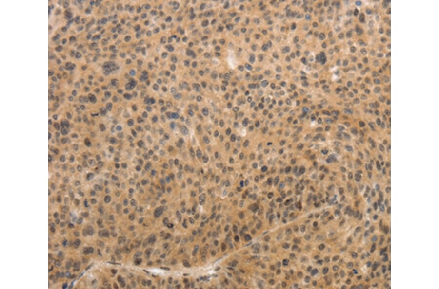Immunohistochemistry - ADIPOR2 Antibody from Signalway Antibody (37086) - Antibodies.com