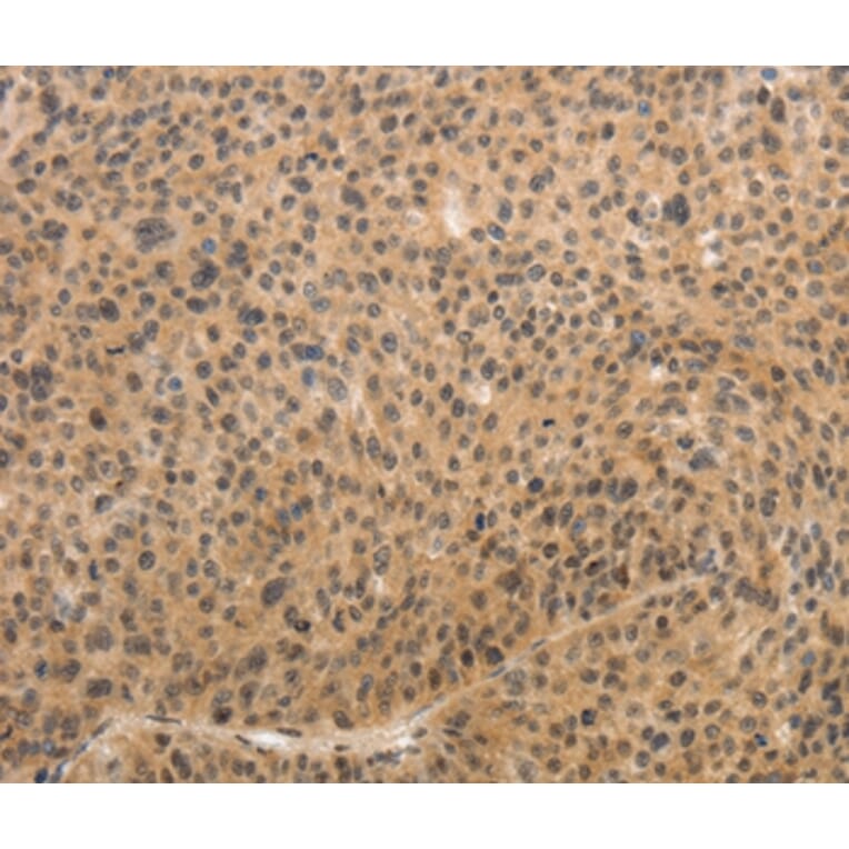 Immunohistochemistry - ADIPOR2 Antibody from Signalway Antibody (37086) - Antibodies.com