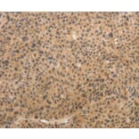 Immunohistochemistry - ADIPOR2 Antibody from Signalway Antibody (37086) - Antibodies.com