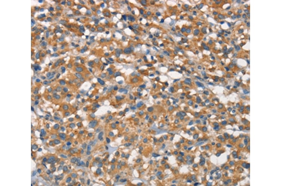 Immunohistochemistry - APOA1BP Antibody from Signalway Antibody (37113) - Antibodies.com
