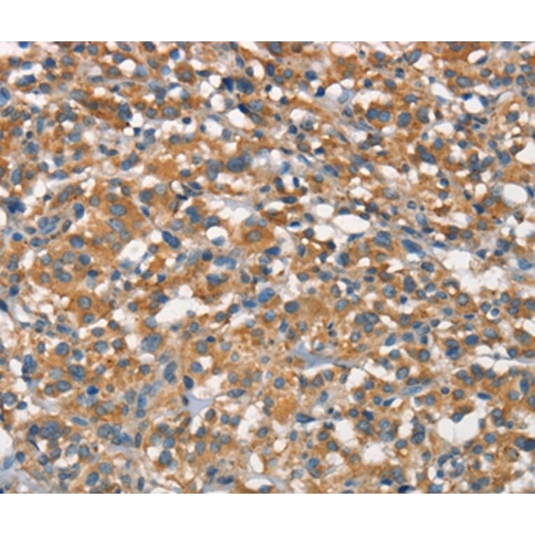 Immunohistochemistry - APOA1BP Antibody from Signalway Antibody (37113) - Antibodies.com