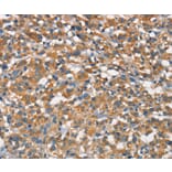 Immunohistochemistry - APOA1BP Antibody from Signalway Antibody (37113) - Antibodies.com