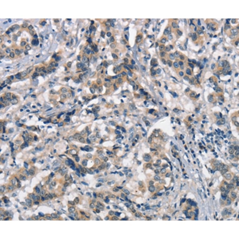Immunohistochemistry - APOA1BP Antibody from Signalway Antibody (37113) - Antibodies.com