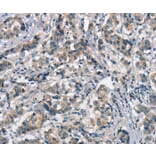 Immunohistochemistry - APOA1BP Antibody from Signalway Antibody (37113) - Antibodies.com