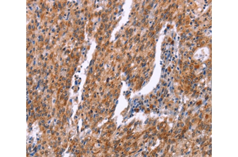 Immunohistochemistry - RPS6KA6 Antibody from Signalway Antibody (37135) - Antibodies.com