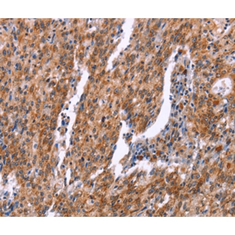 Immunohistochemistry - RPS6KA6 Antibody from Signalway Antibody (37135) - Antibodies.com