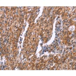 Immunohistochemistry - RPS6KA6 Antibody from Signalway Antibody (37135) - Antibodies.com