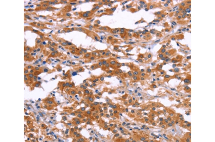Immunohistochemistry - RPS6KA6 Antibody from Signalway Antibody (37135) - Antibodies.com
