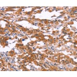 Immunohistochemistry - RPS6KA6 Antibody from Signalway Antibody (37135) - Antibodies.com