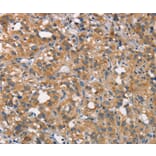 Immunohistochemistry - CEACAM6 Antibody from Signalway Antibody (37163) - Antibodies.com