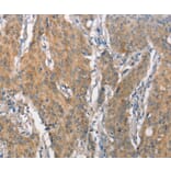 Immunohistochemistry - CEACAM6 Antibody from Signalway Antibody (37163) - Antibodies.com