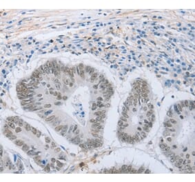 Immunohistochemistry - NEUROG2 Antibody from Signalway Antibody (37185) - Antibodies.com