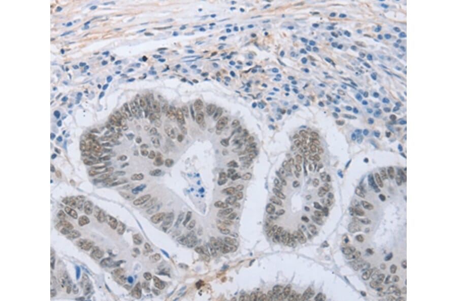 Immunohistochemistry - NEUROG2 Antibody from Signalway Antibody (37185) - Antibodies.com