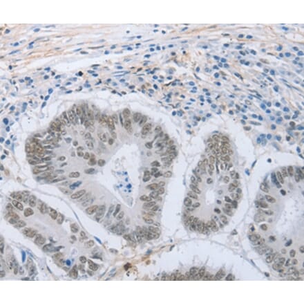 Immunohistochemistry - NEUROG2 Antibody from Signalway Antibody (37185) - Antibodies.com