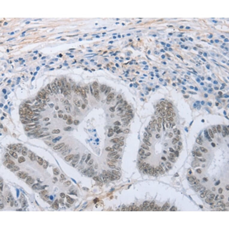 Immunohistochemistry - NEUROG2 Antibody from Signalway Antibody (37185) - Antibodies.com