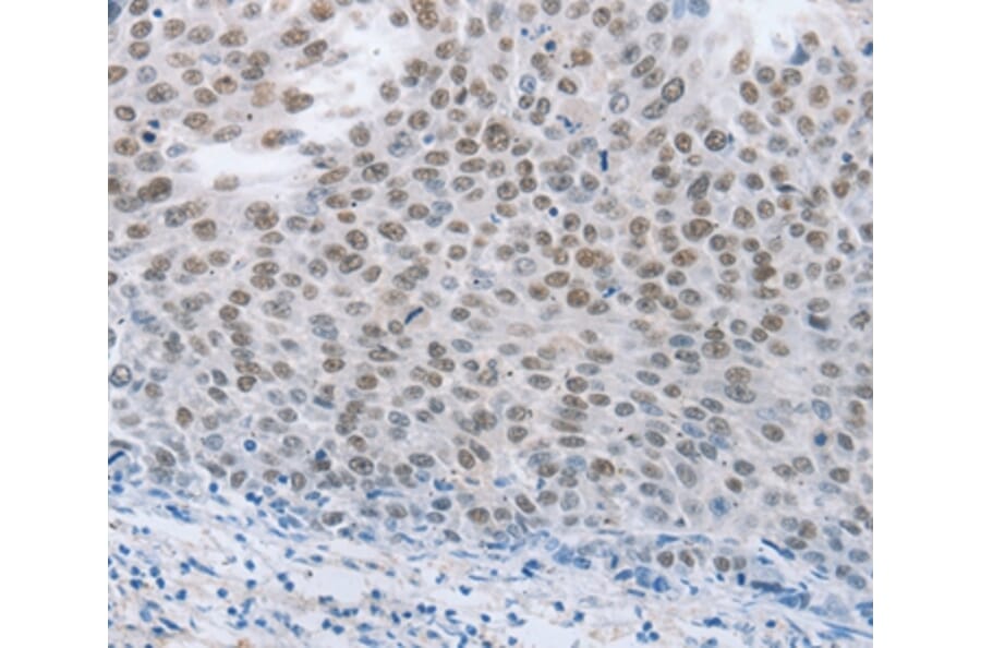 Immunohistochemistry - NEUROG2 Antibody from Signalway Antibody (37185) - Antibodies.com