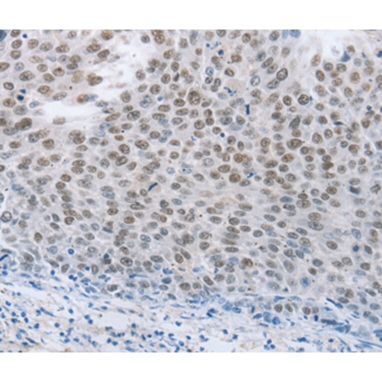 Immunohistochemistry - NEUROG2 Antibody from Signalway Antibody (37185) - Antibodies.com