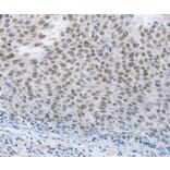 Immunohistochemistry - NEUROG2 Antibody from Signalway Antibody (37185) - Antibodies.com