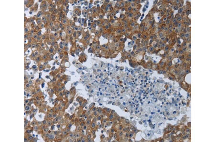 Immunohistochemistry - EIF2AK2 Antibody from Signalway Antibody (37220) - Antibodies.com