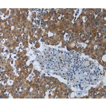 Immunohistochemistry - EIF2AK2 Antibody from Signalway Antibody (37220) - Antibodies.com