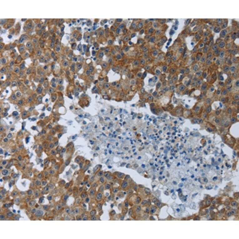 Immunohistochemistry - EIF2AK2 Antibody from Signalway Antibody (37220) - Antibodies.com