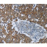 Immunohistochemistry - EIF2AK2 Antibody from Signalway Antibody (37220) - Antibodies.com