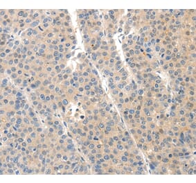 Immunohistochemistry - SLC20A1 Antibody from Signalway Antibody (37243) - Antibodies.com