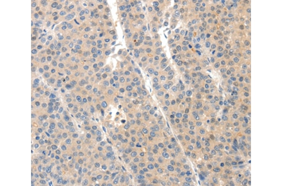 Immunohistochemistry - SLC20A1 Antibody from Signalway Antibody (37243) - Antibodies.com