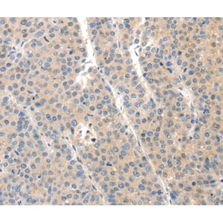 Immunohistochemistry - SLC20A1 Antibody from Signalway Antibody (37243) - Antibodies.com