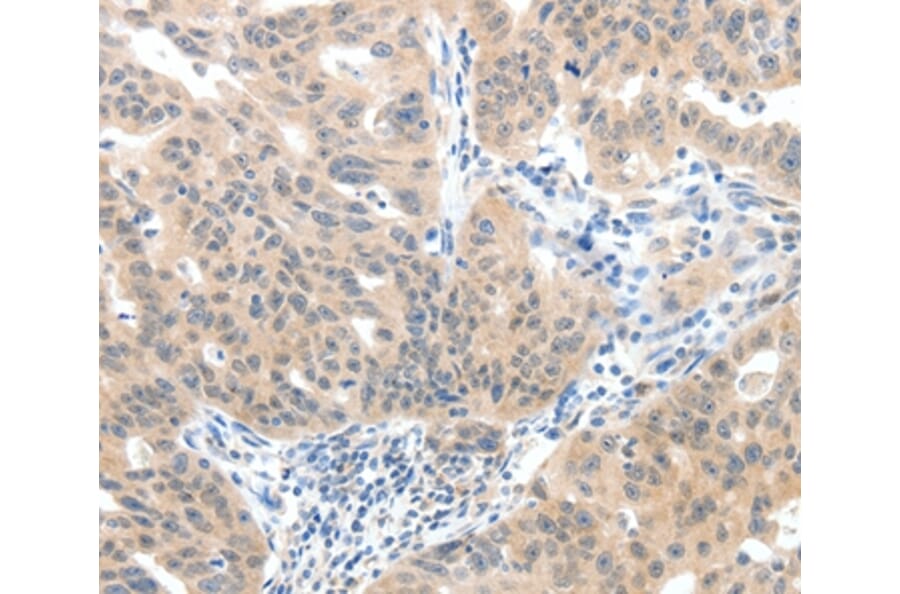 Immunohistochemistry - SLC20A1 Antibody from Signalway Antibody (37243) - Antibodies.com