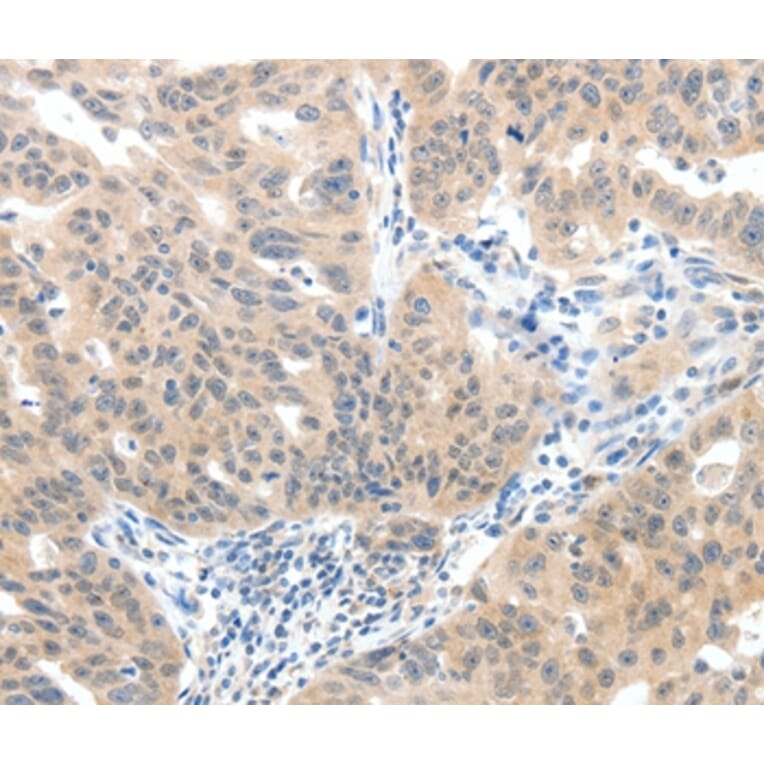 Immunohistochemistry - SLC20A1 Antibody from Signalway Antibody (37243) - Antibodies.com