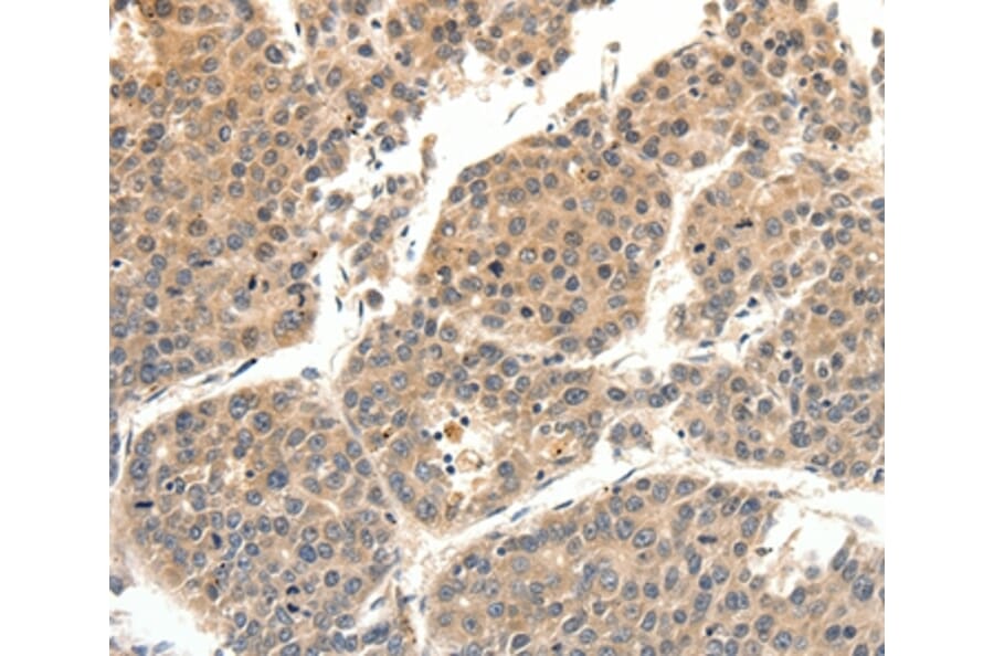 Immunohistochemistry - SLC27A1 Antibody from Signalway Antibody (37246) - Antibodies.com