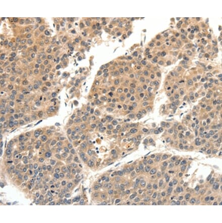 Immunohistochemistry - SLC27A1 Antibody from Signalway Antibody (37246) - Antibodies.com