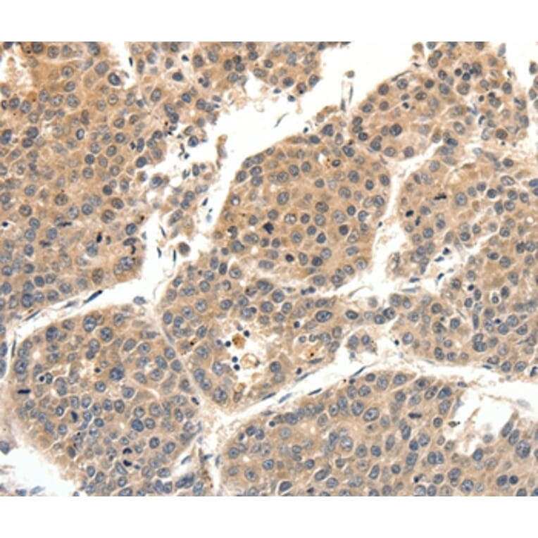 Immunohistochemistry - SLC27A1 Antibody from Signalway Antibody (37246) - Antibodies.com