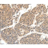 Immunohistochemistry - SLC27A1 Antibody from Signalway Antibody (37246) - Antibodies.com