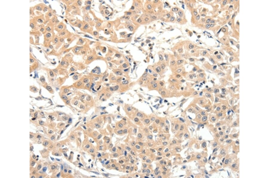 Immunohistochemistry - SLC27A1 Antibody from Signalway Antibody (37246) - Antibodies.com