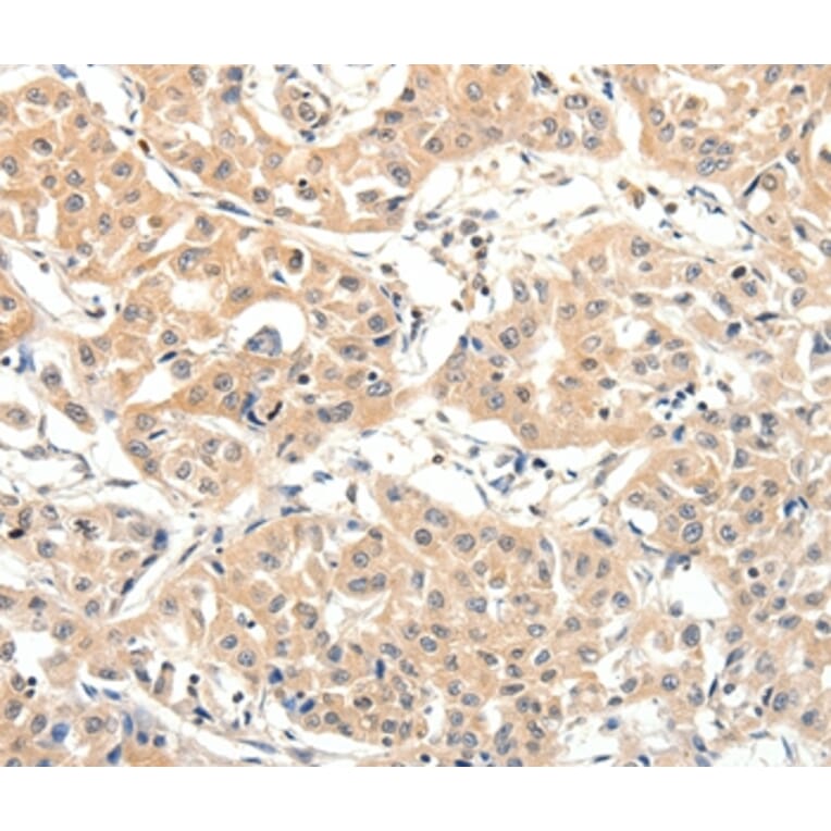 Immunohistochemistry - SLC27A1 Antibody from Signalway Antibody (37246) - Antibodies.com