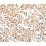 Immunohistochemistry - SLC27A1 Antibody from Signalway Antibody (37246) - Antibodies.com