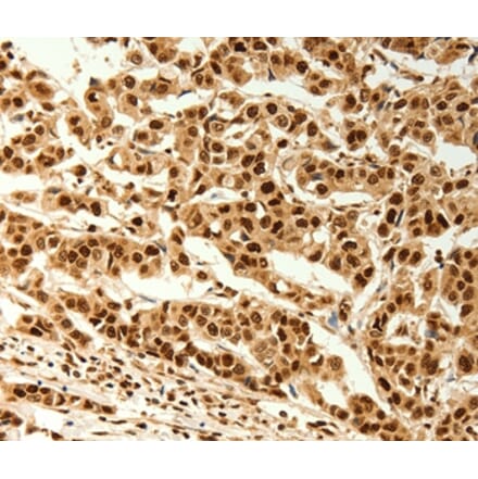 Immunohistochemistry - C12orf5 Antibody from Signalway Antibody (37280) - Antibodies.com
