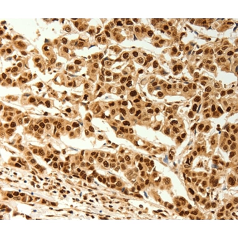 Immunohistochemistry - C12orf5 Antibody from Signalway Antibody (37280) - Antibodies.com