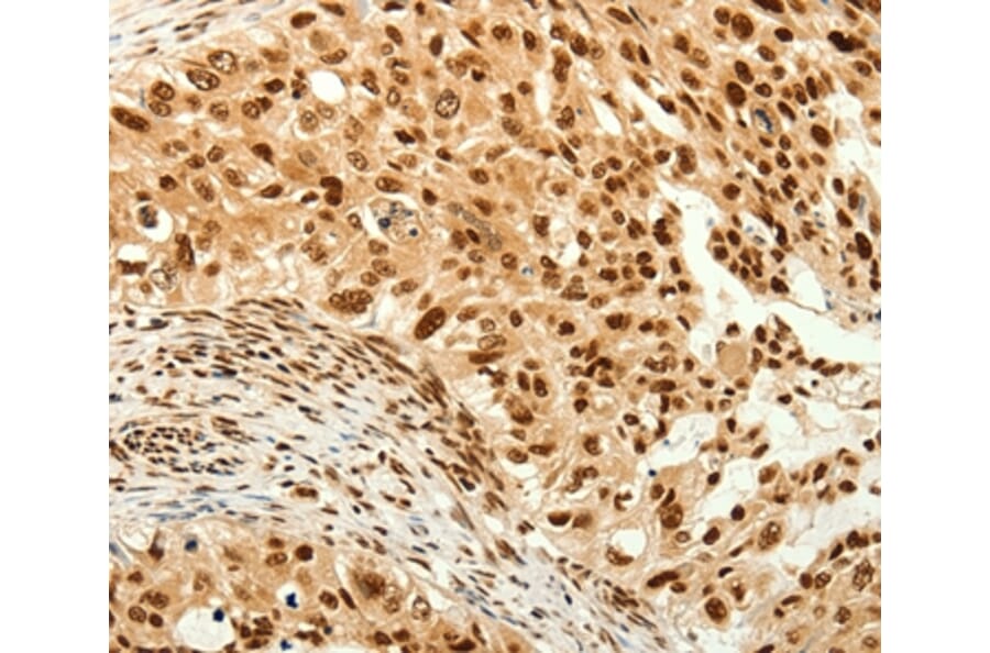 Immunohistochemistry - C12orf5 Antibody from Signalway Antibody (37280) - Antibodies.com
