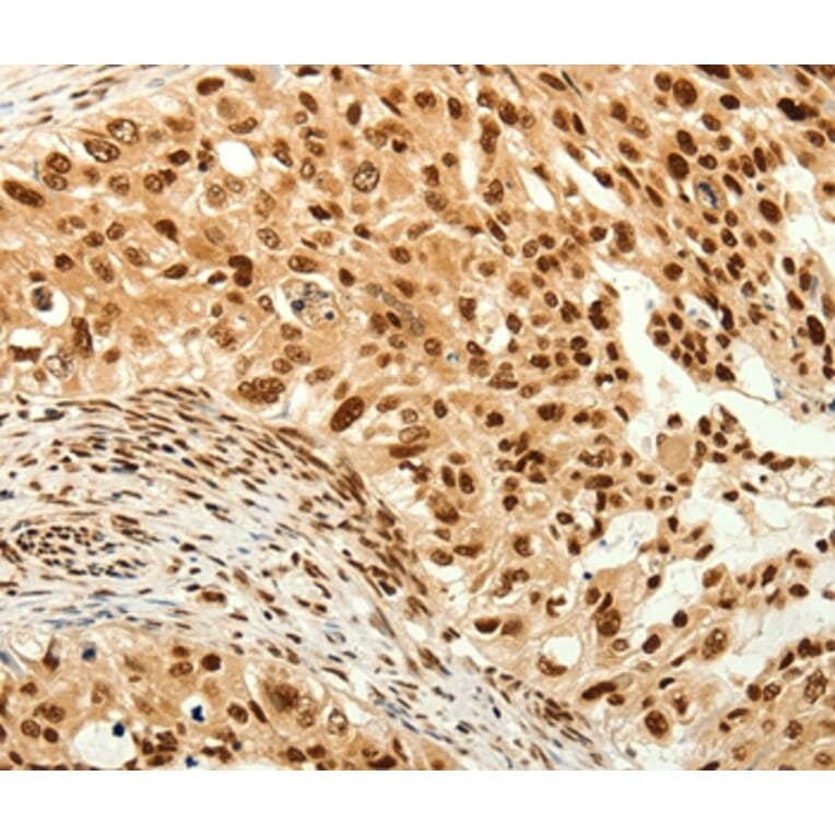 Immunohistochemistry - C12orf5 Antibody from Signalway Antibody (37280) - Antibodies.com