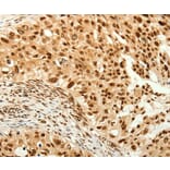 Immunohistochemistry - C12orf5 Antibody from Signalway Antibody (37280) - Antibodies.com