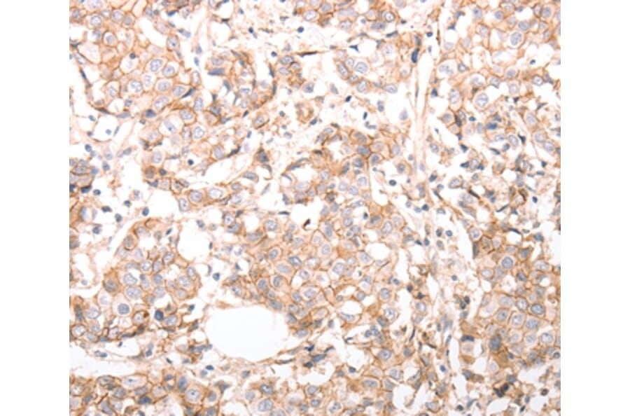 Immunohistochemistry - pan CDH Antibody from Signalway Antibody (37301) - Antibodies.com