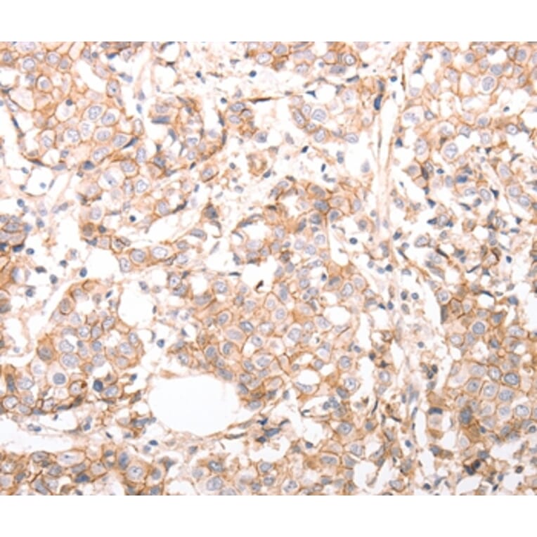Immunohistochemistry - pan CDH Antibody from Signalway Antibody (37301) - Antibodies.com