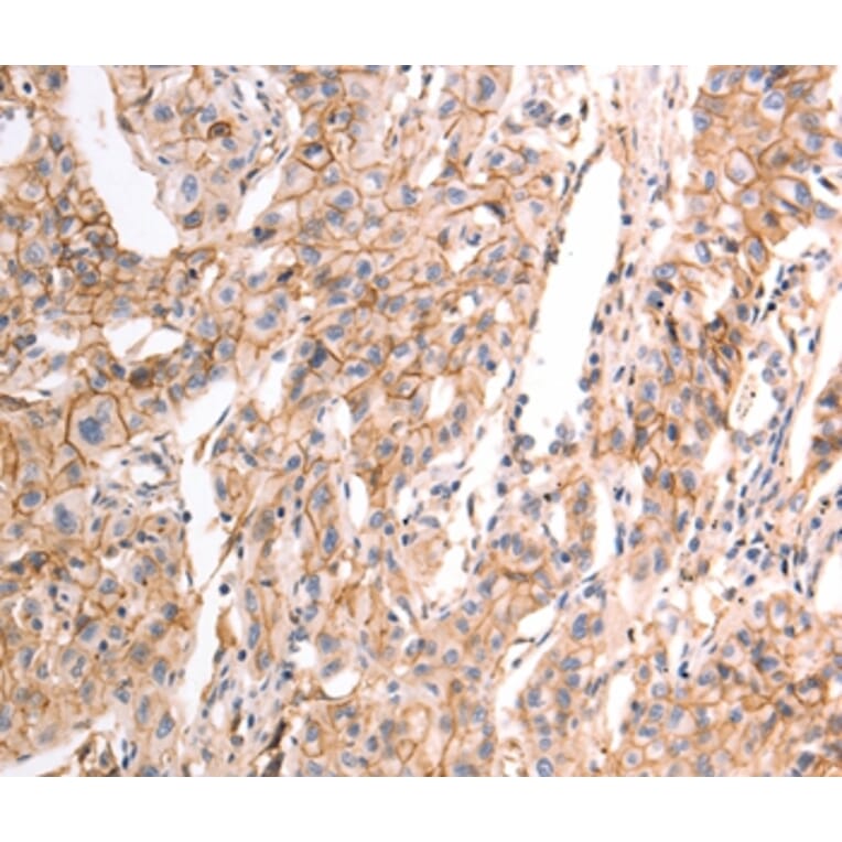 Immunohistochemistry - pan CDH Antibody from Signalway Antibody (37301) - Antibodies.com