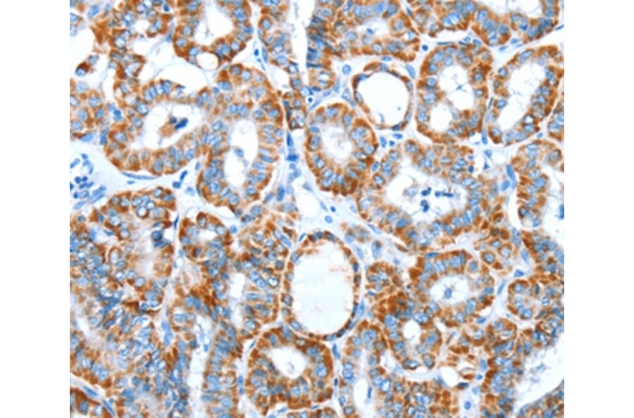 Immunohistochemistry - ALDH5A1 Antibody from Signalway Antibody (37324) - Antibodies.com