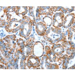 Immunohistochemistry - ALDH5A1 Antibody from Signalway Antibody (37324) - Antibodies.com