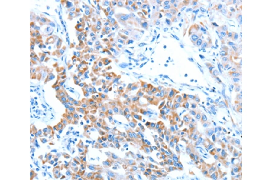 Immunohistochemistry - ALDH5A1 Antibody from Signalway Antibody (37324) - Antibodies.com
